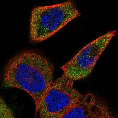 Immunocytochemistry/Immunofluorescence: ACOXL Antibody [NBP2-34002] - staining of human cell line A-431 shows localization to cytosol. Antibody staining is shown in green.