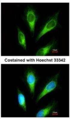 Immunocytochemistry/Immunofluorescence: ACP2 Antibody [NBP2-15250] - Analysis of methanol-fixed HeLa, using ACP2  antibody at 1:200 dilution.