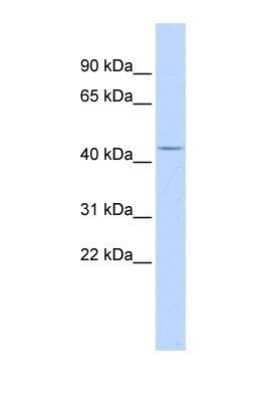 Western Blot ACP2 Antibody