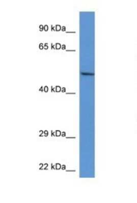 Western Blot: ACP2 Antibody [NBP1-74241] - Mouse Kidney Lysate, Antibody Titration is 1 ug/ml and Gel concentration used is 12%