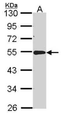 Western Blot: ACP2 Antibody [NBP2-15250] - Sample (30 ug of whole cell lysate) A: A431 10% SDS PAGE Lysosomal acid phosphatase2 antibody, antibody diluted at 1:1000.