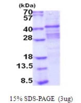 SDS-PAGE Recombinant Human ACP2 His Protein