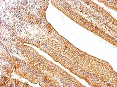 Immunohistochemistry-Paraffin: TRACP/PAP/ACP5 Antibody [NBP1-31535] - Mouse intestine tissue. TRAP antibody dilution: 1:500. Antigen Retrieval: Trilogy™ (EDTA based, pH 8.0) buffer, 15min.