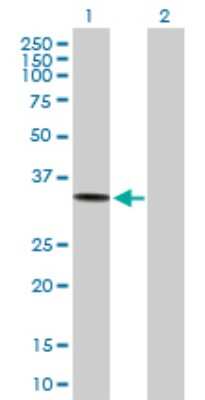 Western Blot: ACP5 Antibody [H00000054-B01P] - Analysis of ACP5 expression in transfected 293T cell line by ACP5 polyclonal antibody.  Lane 1: ACP5 transfected lysate(35.75 KDa). Lane 2: Non-transfected lysate.