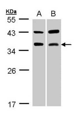 Western Blot: TRACP/PAP/ACP5 Antibody [NBP1-31535] -  Sample(30 ug whole cell lysate) A:A431 B:MOLT4 12% SDS PAGE, antibody diluted at 1:1000.