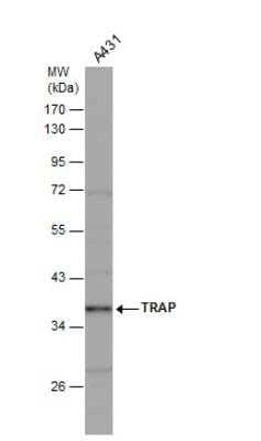 Western Blot: TRACP/PAP/ACP5 Antibody [NBP1-31535] - Whole cell extracts (30 ug) was separated by 10% SDS-PAGE, and the membrane was blotted with TRAP antibody at a dilution of 1:1000. The HRP-conjugated anti-rabbit IgG antibody (NBP2-19301) was used to detect the primary antibody.