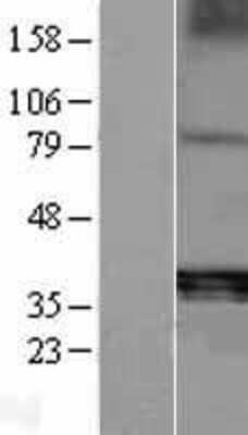 Western Blot: ACP5 Overexpression Lysate (Adult Normal) [NBP2-09379] Left-Empty vector transfected control cell lysate (HEK293 cell lysate); Right -Over-expression Lysate for ACP5.