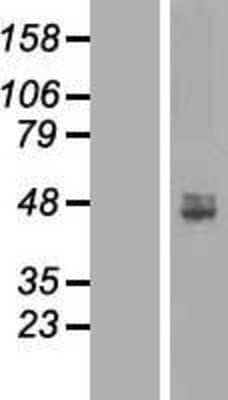 Western Blot: ACP6 Overexpression Lysate (Adult Normal) [NBL1-07253] Left-Empty vector transfected control cell lysate (HEK293 cell lysate); Right -Over-expression Lysate for ACP6.
