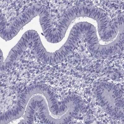 Immunohistochemistry-Paraffin ACRBP Antibody