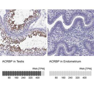 Immunohistochemistry-Paraffin: ACRBP Antibody [NBP1-85407] - Staining in human testis and endometrium tissues using anti-ACRBP antibody. Corresponding ACRBP RNA-seq data are presented for the same tissues.