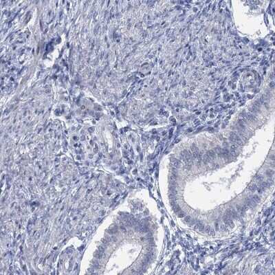 Immunohistochemistry-Paraffin: ACRBP Antibody [NBP1-85408] - Staining of human endometrium shows low expression as expected.