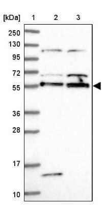 Western Blot: ACRBP Antibody [NBP1-85407] - Lane 1: Marker  [kDa] 250, 130, 95, 72, 55, 36, 28, 17, 10.  Lane 2: Human cell line RT-4.  Lane 3: Human cell line U-251MG sp