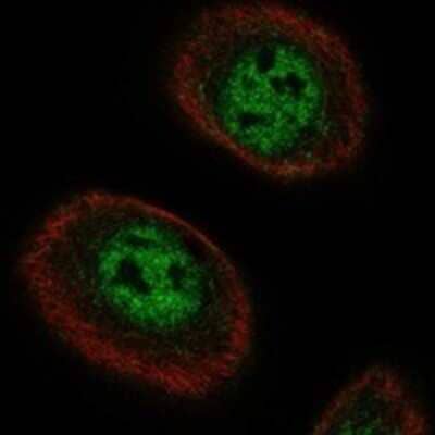 Immunocytochemistry/Immunofluorescence: ACRC Antibody [NBP3-17118] - Staining of human cell line hTCEpi shows localization to nucleoplasm.