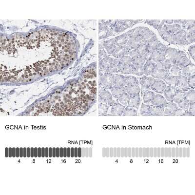Immunocytochemistry/Immunofluorescence: ACRC Antibody [NBP3-17118] - Analysis in human testis and stomach tissues using Anti-GCNA antibody. Corresponding GCNA RNA-seq data are presented for the same tissues.