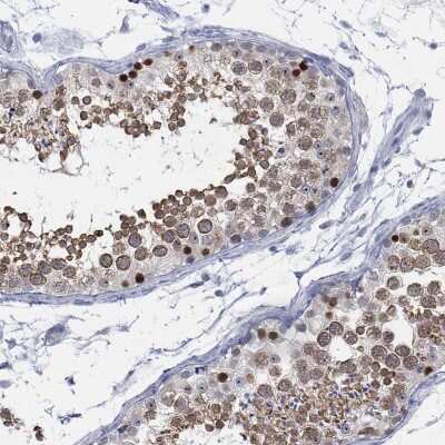 Immunohistochemistry-Paraffin: ACRC Antibody [NBP3-17118] - Staining of human testis shows high expression.