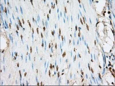 Immunohistochemistry: ACSBG1 Antibody (OTI1D8) - Azide and BSA Free [NBP2-71731] - Staining of paraffin-embedded colon tissue using anti-ACSBG1 mouse monoclonal antibody.