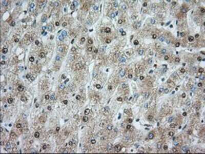 Immunohistochemistry: ACSBG1 Antibody (OTI1D8) - Azide and BSA Free [NBP2-71731] - Staining of paraffin-embedded liver tissue using anti-ACSBG1 mouse monoclonal antibody.
