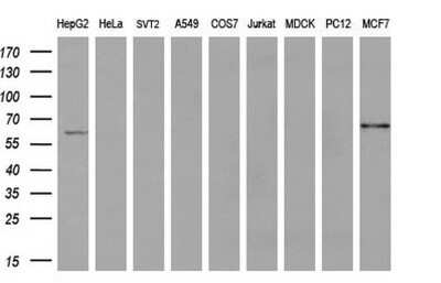 Western Blot: ACSF2 Antibody (OTI6E4) - Azide and BSA Free [NBP2-72220] - Analysis of extracts (35ug) from 9 different cell lines by using anti-ACSF2 monoclonal antibody (HepG2: human; HeLa: human; SVT2: mouse; A549: human; COS7: monkey; Jurkat: human; MDCK: canine; PC12: rat; MCF7: human) (1:200).