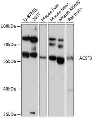 Western Blot: ACSF3 Antibody [NBP2-92125] - Analysis of extracts of various cell lines, using ACSF3 at 1:3000 dilution.Secondary antibody: HRP Goat Anti-Rabbit IgG (H+L) at 1:10000 dilution.Lysates/proteins: 25ug per lane.Blocking buffer: 3% nonfat dry milk in TBST.Detection: ECL Basic Kit .Exposure time: 60s.