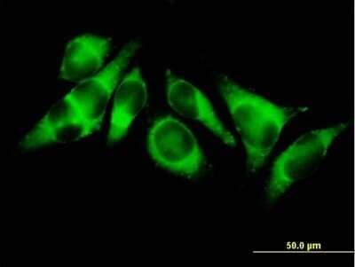 Immunocytochemistry/Immunofluorescence: ACSL3 Antibody [H00002181-B01P] - Analysis of purified antibody to ACSL3 on HeLa cell. (antibody concentration 10 ug/ml)