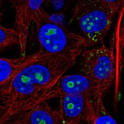 Immunocytochemistry/Immunofluorescence: ACSL3 Antibody [NBP2-58817] - Staining of human cell line SK-MEL-30 shows localization to nucleoli & lipid droplets.