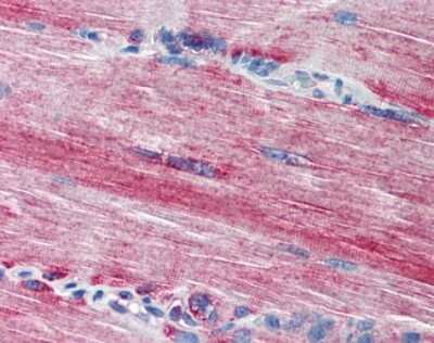 Immunohistochemistry-Paraffin: ACSL3 Antibody [NBP1-39770] - Analysis of anti-ACSL3 antibody with human skeletal muscle at concentration 20 ug/ml.