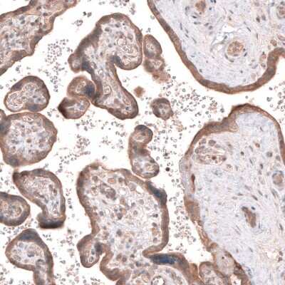 Immunohistochemistry-Paraffin: ACSL3 Antibody [NBP1-89268] - Staining of human placenta shows moderate cytoplasmic positivity in trophoblastic cells.