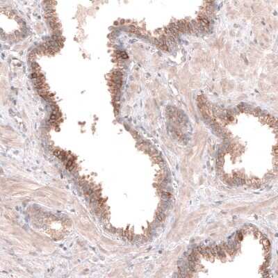 Immunohistochemistry-Paraffin: ACSL3 Antibody [NBP1-89268] - Staining of human prostate shows moderate cytoplasmic positivity in glandular cells.
