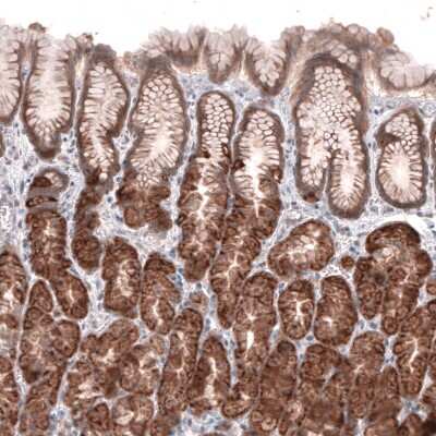Immunohistochemistry-Paraffin: ACSL3 Antibody [NBP1-89268] - Staining of human stomach shows moderate cytoplasmic positivity in glandular cells.