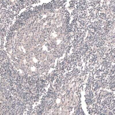 Immunohistochemistry-Paraffin: ACSL3 Antibody [NBP1-89268] - Staining of human tonsil shows no positivity in lymphoid cells as expected.