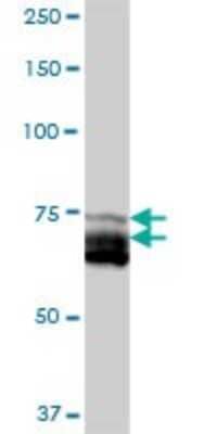 Western Blot: ACSL5 Antibody [H00051703-B01P] - Analysis of ACSL5 expression in human liver.
