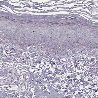 <b>Orthogonal Strategies Validation. </b>Immunohistochemistry-Paraffin: ACSL6 Antibody [NBP1-89269] - Staining of human skin shows low expression as expected.