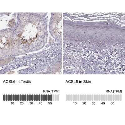 Immunohistochemistry-Paraffin: ACSL6 Antibody [NBP1-89269] - Staining in human testis and skin tissues using anti-ACSL6 antibody. Corresponding ACSL6 RNA-seq data are presented for the same tissues.