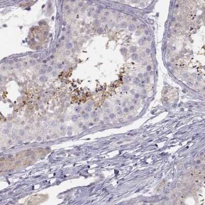 Immunohistochemistry-Paraffin: ACSL6 Antibody [NBP1-89269] - Staining of human testis shows high expression.