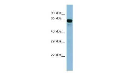 Western Blot: ACSL6 Antibody [NBP2-84390] - Host: Rabbit. Target Name: ACSL6. Sample Type: Fetal Kidney lysates. Antibody Dilution: 1.0ug/ml