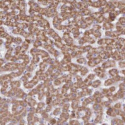 Immunohistochemistry-Paraffin ACSM2A Antibody - BSA Free