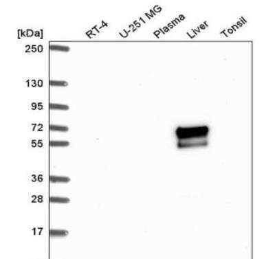 Western Blot ACSM2A Antibody - BSA Free