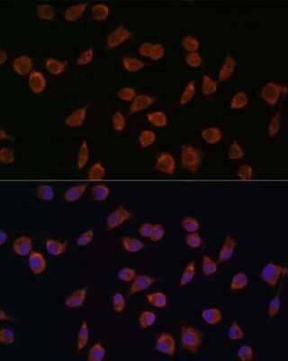 Immunocytochemistry/Immunofluorescence: ACSS1 Antibody [NBP2-92202] - Analysis of L929 cells using ACSS1 at dilution of 1:100. Blue: DAPI for nuclear staining.