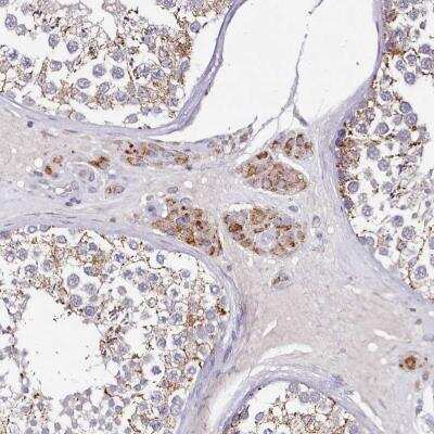 Immunohistochemistry-Paraffin: ACSS1 Antibody [NBP2-30635] - Immunohistochemical staining of human testis shows moderate granular cytoplasmic positivity in Leydig cells.