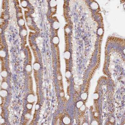 Immunohistochemistry-Paraffin: ACSS1 Antibody [NBP2-30635] - Immunohistochemical staining of human upper duodenum shows moderate granular cytoplasmic positivity in glandular cells.