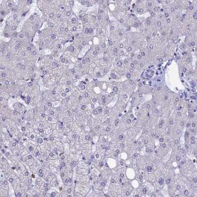 Immunohistochemistry-Paraffin: ACSS1 Antibody [NBP2-30612] - Staining of human liver shows low expression as expected.