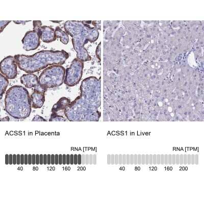 <b>Orthogonal Strategies Validation. </b>Immunohistochemistry-Paraffin: ACSS1 Antibody [NBP2-30612] - Staining in human placenta and liver tissues using anti-ACSS1 antibody. Corresponding ACSS1 RNA-seq data are presented for the same tissues.