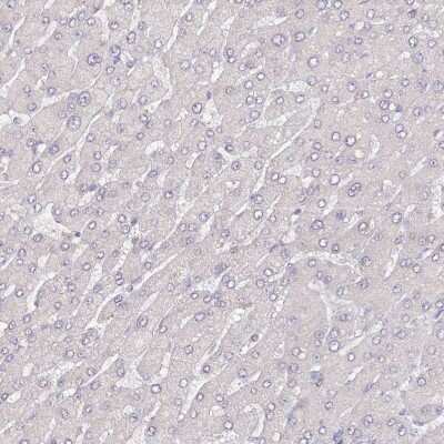 Immunohistochemistry-Paraffin: ACSS1 Antibody [NBP2-30635] - Staining of human liver shows low expression as expected.