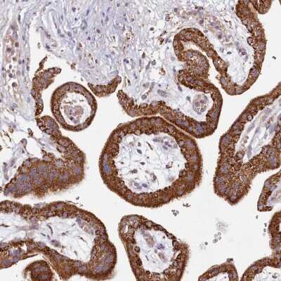 Immunohistochemistry-Paraffin: ACSS1 Antibody [NBP2-30635] - Staining of human placenta shows high expression.