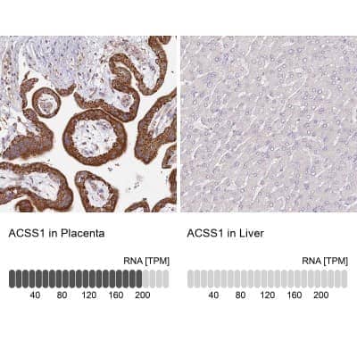 Immunohistochemistry-Paraffin: ACSS1 Antibody [NBP2-30635] - Staining in human placenta and liver tissues using anti-ACSS1 antibody. Corresponding ACSS1 RNA-seq data are presented for the same tissues.