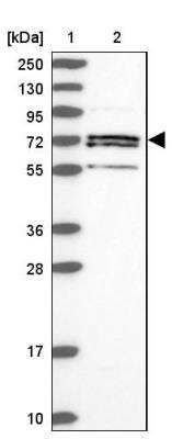 Western Blot: ACSS1 Antibody [NBP2-30612] - Lane 1: Marker  [kDa] 250, 130, 95, 72, 55, 36, 28, 17, 10.  Lane 2: Human cell line RT-4