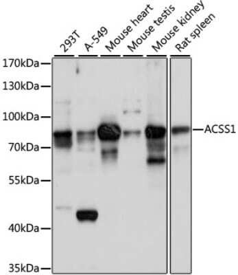 Western Blot: ACSS1 Antibody [NBP2-92202] - Analysis of extracts of various cell lines, using ACSS1 at 1:1000 dilution.Secondary antibody: HRP Goat Anti-Rabbit IgG (H+L) at 1:10000 dilution.Lysates/proteins: 25ug per lane.Blocking buffer: 3% nonfat dry milk in TBST.Detection: ECL Basic Kit .Exposure time: 10s.