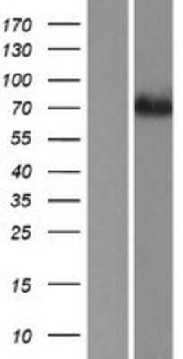 Western Blot: ACSS1 Overexpression Lysate (Adult Normal) [NBP2-06010] Left-Empty vector transfected control cell lysate (HEK293 cell lysate); Right -Over-expression Lysate for ACSS1.