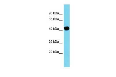 Western Blot: ACTBL2 Antibody [NBP3-09672] - Western blot analysis of ACTBL2 in Placenta lysates. Antibody dilution at 1.0ug/ml