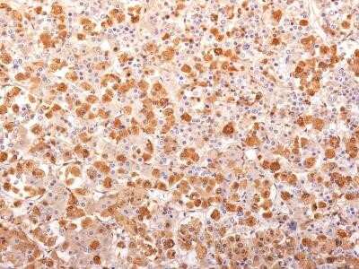 Immunohistochemistry-Paraffin: ACTH Antibody (AH26 + 57) - Azide and BSA Free [NBP2-34550] - Formalin-fixed, paraffin-embedded human Pituitary Gland stained with ACTH Monoclonal Antibody (AH26 + 57).